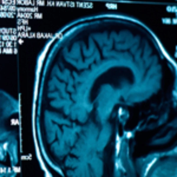 Brain Injury